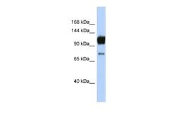 ABCA2 Rabbit anti-Human, Polyclonal, Novus Biologicals 0.1 mL | Buy Online | Novus Biologicals | Fisher Scientific